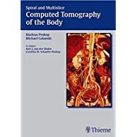 Spiral and Multislice Computed Tomography of the Body